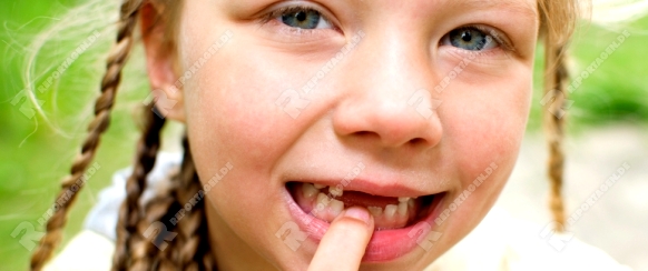 kleines Mädchen mit langen Zöpfen und Zahnlücke vor Grunem Hintergrund